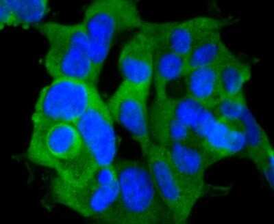 Immunocytochemistry/Immunofluorescence: RSK1 [p Ser380] Antibody (SC05-32) [NBP2-67570] - Staining Phospho-RSK1(S380) in 293 cells (green). The nuclear counter stain is DAPI (blue). Cells were fixed in paraformaldehyde, permeabilised with 0.25% Triton X100/PBS.