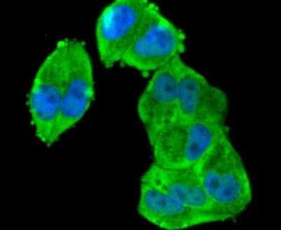 Immunocytochemistry/Immunofluorescence: RSK1 [p Ser380] Antibody (SC05-32) [NBP2-67570] - Staining Phospho-RSK1(S380) in Hela cells (green). The nuclear counter stain is DAPI (blue). Cells were fixed in paraformaldehyde, permeabilised with 0.25% Triton X100/PBS.