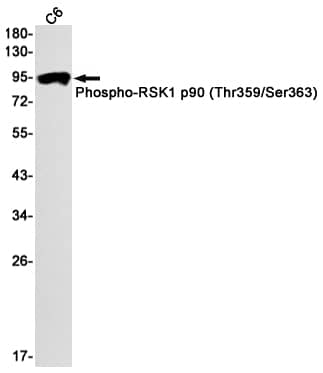 Western Blot: RSK1 [p Thr359, p Ser363] Antibody (S01-5B1) [NBP3-20023] - Western blot detection of RSK1 in C6 cell lysates using NBP3-20023 (1:1000 diluted). Predicted band size: 83kDa. Observed band size: 90kDa.