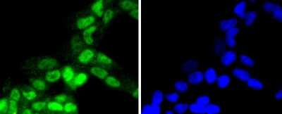 Immunocytochemistry/Immunofluorescence: RSK1 [p Thr359, p Ser363] Antibody (SU03-65) [NBP2-67480] - Staining Phospho-RSK1 p90(T359+S363) in 293 cells (green). The nuclear counter stain is DAPI (blue). Cells were fixed in paraformaldehyde, permeabilised with 0.25% Triton X100/PBS.