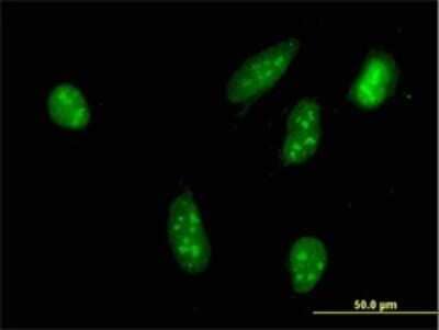 Immunocytochemistry/Immunofluorescence: RSK3 Antibody (1F6) [H00006196-M01] - Analysis of monoclonal antibody to RPS6KA2 on HeLa cell. Antibody concentration 10 ug/ml.