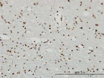 Immunohistochemistry-Paraffin: RSK3 Antibody (1F6) [H00006196-M01] - Analysis of monoclonal antibody to RPS6KA2 on formalin-fixed paraffin-embedded human cerebral cortex. Antibody concentration 3 ug/ml.