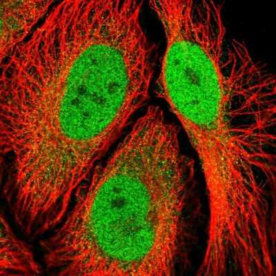 Immunocytochemistry/Immunofluorescence: RSK3 Antibody [NBP2-48825] - Immunofluorescent staining of human cell line HeLa shows localization to nucleoplasm.