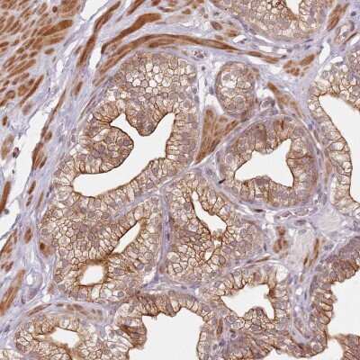 Immunohistochemistry-Paraffin: RSK3 Antibody [NBP2-48825] - Staining of human prostate shows strong cytoplasmic and membranous positivity in glandular cells.