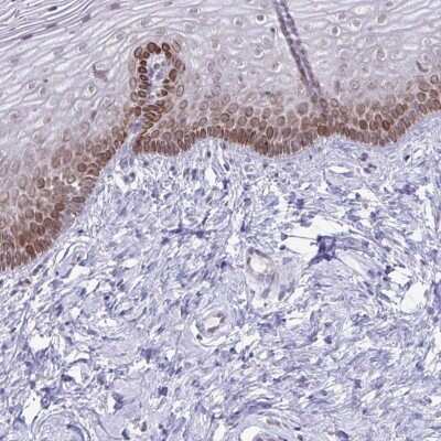 Immunohistochemistry-Paraffin: RSK3 Antibody [NBP2-49125] - Staining of human vagina shows moderate cytoplasmic and nuclear membranous positivity in squamous epithelial cells.
