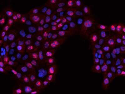 Immunocytochemistry/Immunofluorescence: RSL1D1 Antibody [NBP2-97626] - Immunofluorescence staining of RSL1D1 in A431 cells. Cells were fixed with 4% PFA, permeabilzed with 0.1% Triton X-100 in PBS, blocked with 10% serum, and incubated with rabbit anti-Human RSL1D1 polyclonal antibody (dilution ratio 1:200) at 4C overnight. Then cells were stained with the Alexa Fluor(R)594-conjugated Goat Anti-rabbit IgG secondary antibody (red) and counterstained with DAPI (blue).Positive staining was localized to Nucleolus.