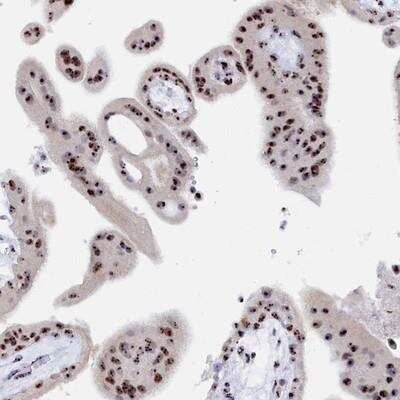 Immunohistochemistry-Paraffin: RSL1D1 Antibody [NBP2-13269] - Staining of human placenta shows strong nucleolar positivity in trophoblastic cells.