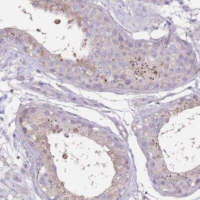 Immunohistochemistry RSPH10B Antibody - BSA Free