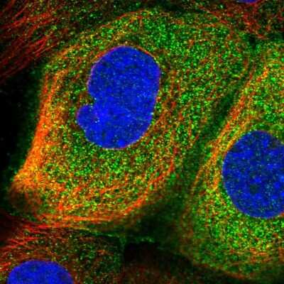 Immunocytochemistry/Immunofluorescence: RSPH3 Antibody [NBP1-84245] - Immunofluorescent staining of human cell line A-431 shows localization to plasma membrane &amp; cytosol.