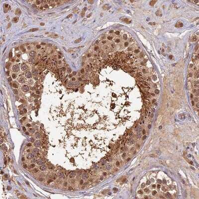 Immunohistochemistry-Paraffin: RSPH3 Antibody [NBP1-84245] - Staining of human testis shows moderate cytoplasmic and nuclear positivity in cells in seminiferus ducts.