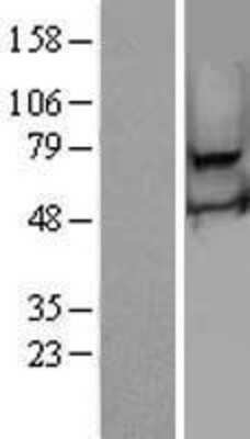 Western Blot: RSPH3 Overexpression Lysate (Adult Normal) [NBL1-15600] Left-Empty vector transfected control cell lysate (HEK293 cell lysate); Right -Over-expression Lysate for RSPH3.