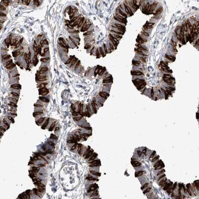 Immunohistochemistry-Paraffin RSPH4A Antibody - BSA Free