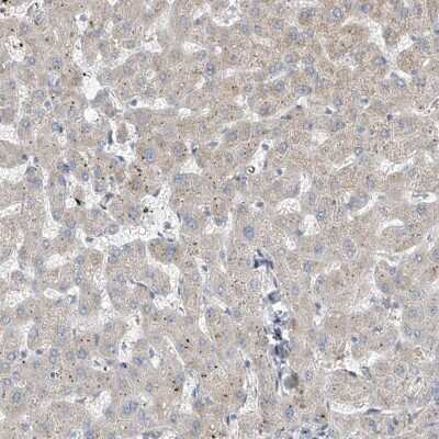 Immunohistochemistry-Paraffin RSPH4A Antibody - BSA Free