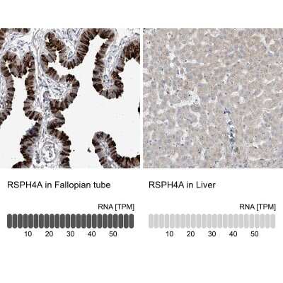 Immunohistochemistry-Paraffin RSPH4A Antibody - BSA Free
