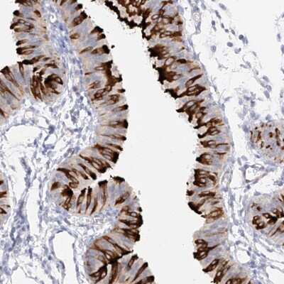 Immunohistochemistry-Paraffin RSPH4A Antibody - BSA Free