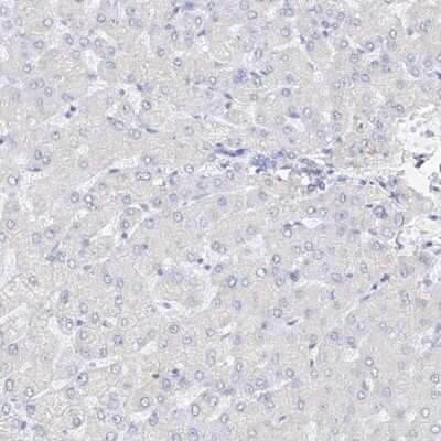 Immunohistochemistry-Paraffin RSPH4A Antibody - BSA Free