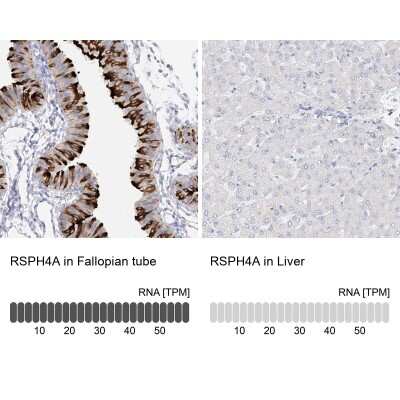 Immunohistochemistry-Paraffin RSPH4A Antibody - BSA Free
