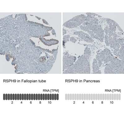 Immunohistochemistry-Paraffin RSPH9 Antibody - BSA Free