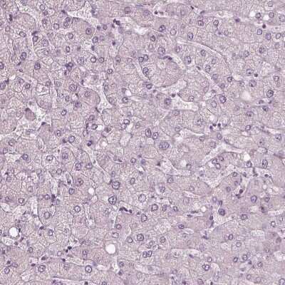 Immunohistochemistry-Paraffin: RSPH9 Antibody [NBP1-86750] - Staining of human liver shows no positivity in hepatocytes as expected.