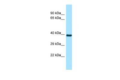 Western Blot: RSPH9 Antibody [NBP2-83480] - WB Suggested Anti-RSPH9 Antibody. Titration: 1.0 ug/ml. Positive Control: 721_B Whole Cell