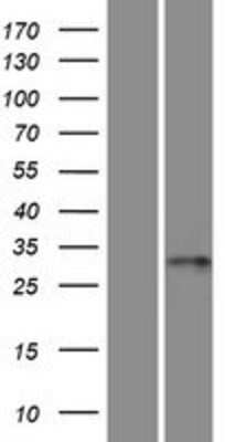 Western Blot: RSPH9 Overexpression Lysate (Adult Normal) [NBP2-05318] Left-Empty vector transfected control cell lysate (HEK293 cell lysate); Right -Over-expression Lysate for RSPH9.