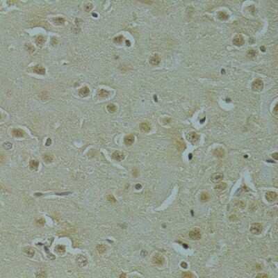 Immunohistochemistry-Paraffin: RSRC1 Antibody [NBP2-93020] - Mouse brain using RSRC1 antibody at dilution of 1:100 (40x lens).