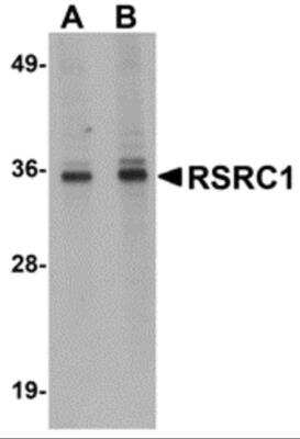 Western Blot: RSRC1 Antibody [NBP2-81778] - Analysis of RSRC1 in HepG2 cell lysate with RSRC1 antibody at (A) 1 and (B) 2 ug/ml.