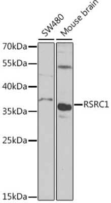 Western Blot: RSRC1 Antibody [NBP2-93020] - Analysis of extracts of various cell lines, using RSRC1 at 1:1000 dilution. Secondary antibody: HRP Goat Anti-Rabbit IgG (H+L) at 1:10000 dilution. Lysates/proteins: 25ug per lane. Blocking buffer: 3% nonfat dry milk in TBST. Detection: ECL Basic Kit . Exposure time: 90s.