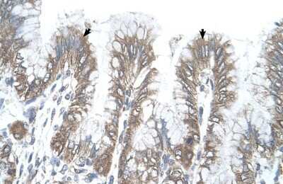 Immunohistochemistry-Paraffin: RSRC2 Antibody [NBP1-54332] - Human Stomach Tissue, Epithelial cells of funic gland (Indicated with Arrows) 4-8ug/ml.