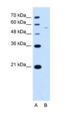 Western Blot: RSRC2 Antibody [NBP1-54332] - Titration: 2.5 ug/ml Positive Control: Jurkat cell lysate.