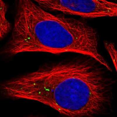 Immunocytochemistry/ Immunofluorescence RSU1 Antibody