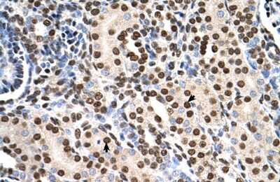 Immunohistochemistry-Paraffin: RSU1 Antibody [NBP1-54879] - Human kidney Tissue, antibody concentration 4-8ug/ml. Cells with positive label: renal corpuscle cells (indicated with arrows) 400X magnification.