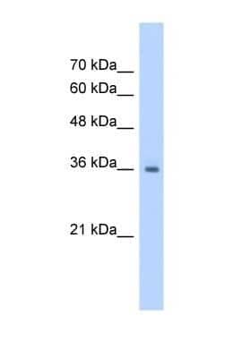 Western Blot: RSU1 Antibody [NBP1-54879] - Jurkat tissue lysate at a concentration of 1.25ug/ml.