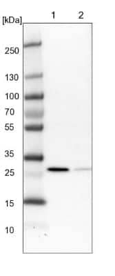 Western Blot: RSU1 Antibody [NBP1-82029] - Lane 1: NIH-3T3 cell lysate (Mouse embryonic fibroblast cells). Lane 2: NBT-II cell lysate (Rat Wistar bladder tumor cells).