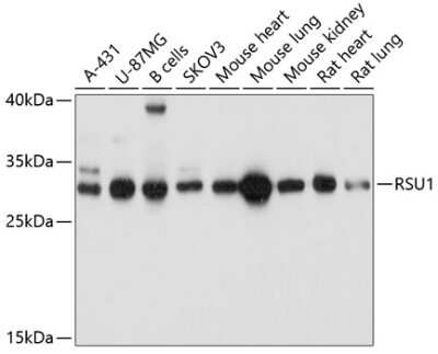 Western Blot: RSU1 Antibody [NBP2-94442] - Analysis of extracts of various cell lines, using RSU1 at 1:1000 dilution. Secondary antibody: HRP Goat Anti-Rabbit IgG (H+L) at 1:10000 dilution. Lysates/proteins: 25ug per lane. Blocking buffer: 3% nonfat dry milk in TBST. Detection: ECL Basic Kit . Exposure time: 5s.