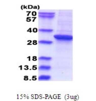 SDS-Page: RSU1 Recombinant Protein [NBP2-51675] - 15% SDS Page (3 ug)