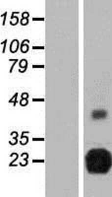 Western Blot: RTBDN Overexpression Lysate (Adult Normal) [NBP2-08415] Left-Empty vector transfected control cell lysate (HEK293 cell lysate); Right -Over-expression Lysate for RTBDN.