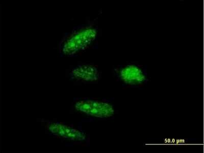 Immunocytochemistry/Immunofluorescence: RTCD1 Antibody [H00008634-B01P] - Analysis of purified antibody to RTCD1 on HeLa cell. (antibody concentration 10 ug/ml)