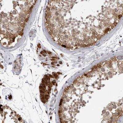 Immunohistochemistry: RTCD1 Antibody [NBP1-87112] - Staining of human testis shows strong cytoplasmic positivity in leydig cells.