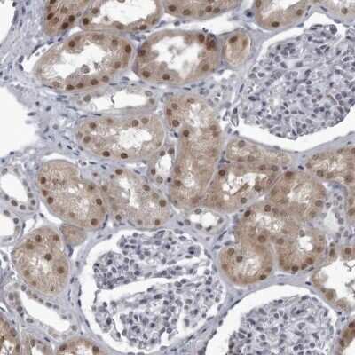 Immunohistochemistry-Paraffin: RTCD1 Antibody [NBP1-87113] - Staining of human kidney shows moderate nuclear and cytoplasmic positivity in cells in tubules.