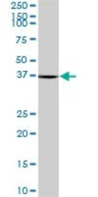 Western Blot RTCD1 Antibody