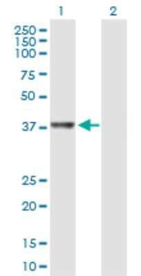Western Blot: RTCD1 Antibody [H00008634-B01P] - Analysis of RTCD1 expression in transfected 293T cell line by RTCD1 polyclonal antibody.  Lane 1: RTCD1 transfected lysate(40.26 KDa). Lane 2: Non-transfected lysate.
