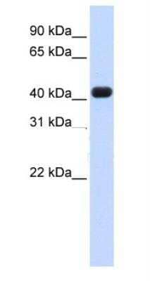 Western Blot: RTCD1 Antibody [NBP1-57245] - Human Heart lysate, concentration 0.2-1 ug/ml.