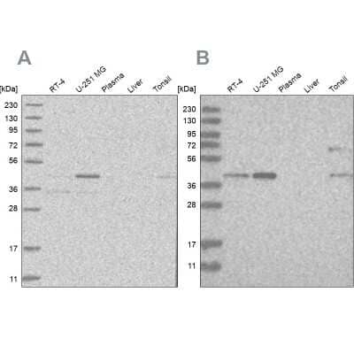 Western Blot RTCD1 Antibody