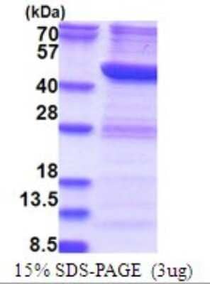 SDS-PAGE Recombinant Human RTCD1 His Protein