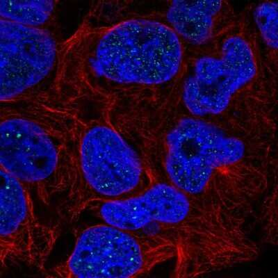 Immunocytochemistry/ Immunofluorescence RTEL1 Antibody