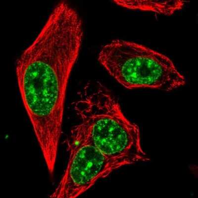 Immunocytochemistry/ Immunofluorescence RTEL1 Antibody