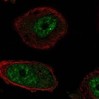 Immunocytochemistry/Immunofluorescence: RTEL1 Antibody [NBP2-69067] - Staining of human cell line PC-3 shows localization to nuclear speckles. Antibody staining is shown in green.