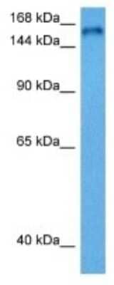 Western Blot: RTEL1 Antibody [NBP3-10036] - Western blot analysis of RTEL1 in Human Lung Tumor lysates. Antibody dilution at 1ug/ml