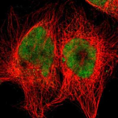 Immunocytochemistry/Immunofluorescence: RTF1 Antibody [NBP1-83019] - Immunofluorescent staining of human cell line A-431 shows localization to nucleus & cytosol.